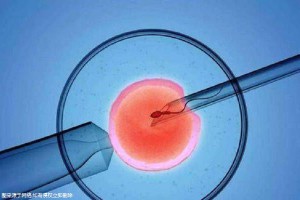 无精症案例